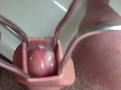 15-minute foreskin video jizz