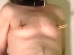 Dr Peeemeee and Fabio: penis treatment