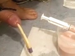 500cc of yogurt in my bladder