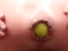 Extreme anal sex