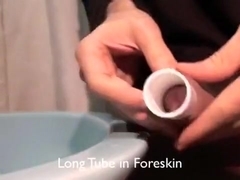 two,75 inches lengthy plastic tube in foreskin