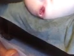 Anal prolapse with double anal dildo squirt