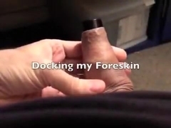 Docking my foreskin