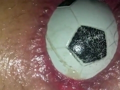 Anal gaping close up