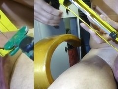 auto needle in prepuc foreskin with modified cartridge glue diffuser